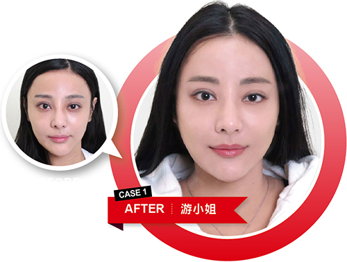 預訂妳 更年輕的未來