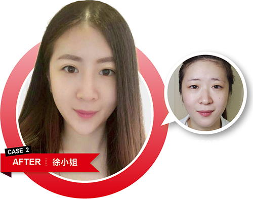 預訂妳 更年輕的未來
