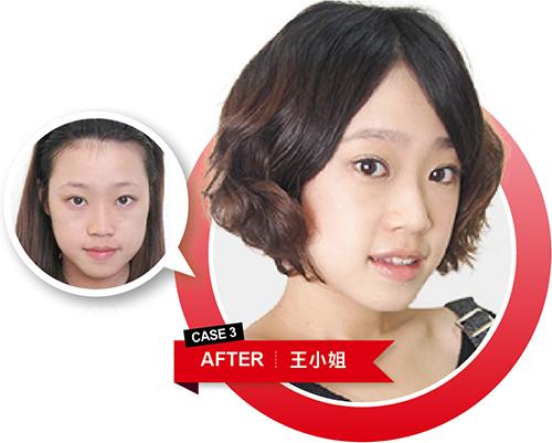 預訂妳 更年輕的未來
