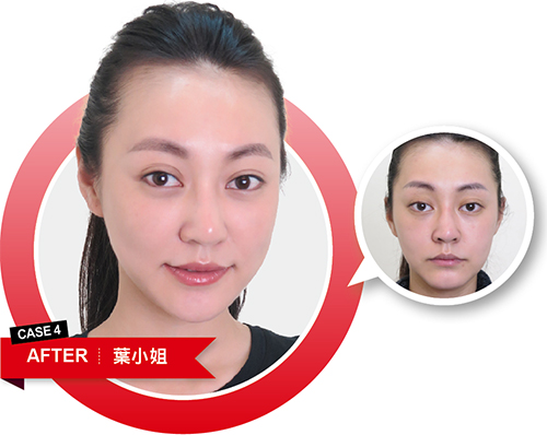 預訂妳 更年輕的未來