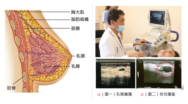 隆乳,安全隆乳,东京风采,整形,丰胸,隆乳手术,不痛,快速,恢复快,无疤,方便,不需要按摩,隆乳新技术,推荐,医师,权威,伤口小,首选,3d隆乳,5d隆乳,模特儿,小模,空姐,名媛,首创,整形突破,改造,风靡,创新