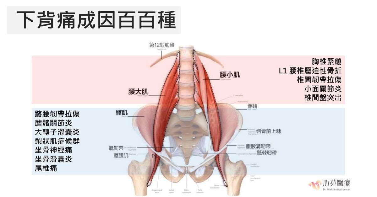 心苑診所,幹細胞,下背痛,再生醫療