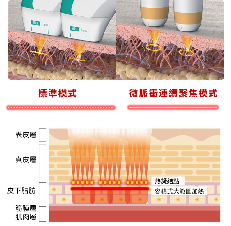 索夫波、海芙媚必提接連來台 翻轉電音波緊緻拉提市場