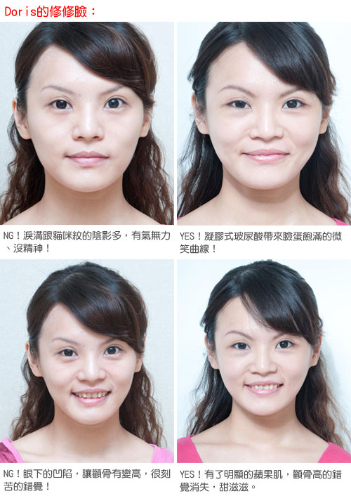 一臉苦命相 昔日玉女偶像也中箭 滿足你對整形知識的需求 提供正確的整形觀念 隨意窩xuite日誌