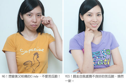 凝膠式玻尿酸注射─現代苦情女，自我感覺良好，最重要！