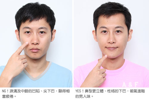botox744.jpg