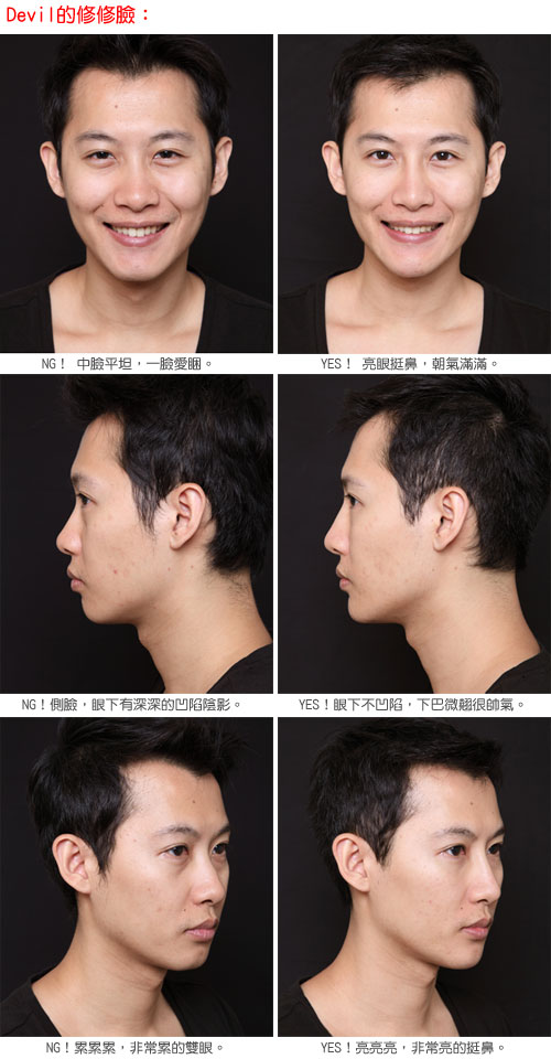 botox745.jpg