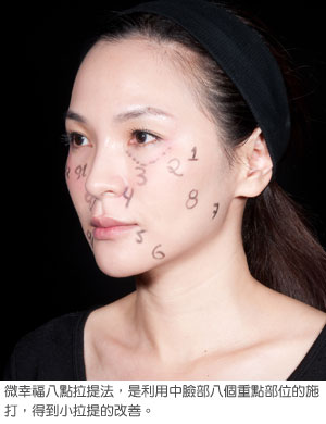 botox759.jpg