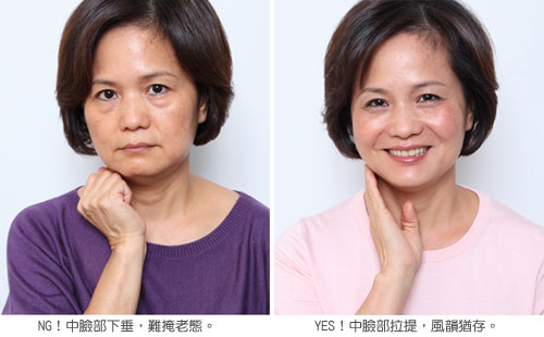 botox760.jpg