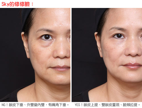 botox761.jpg
