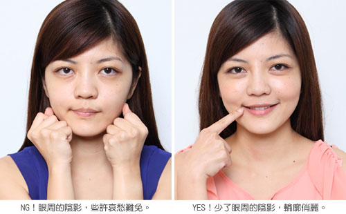 botox781.jpg