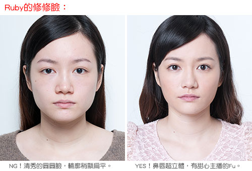 botox802.jpg